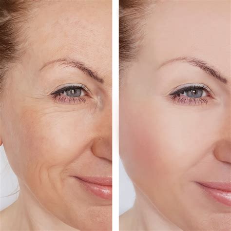 Unlocking The Golden Secrets: The Benefits Of Turmeric Soap - Simple N ...