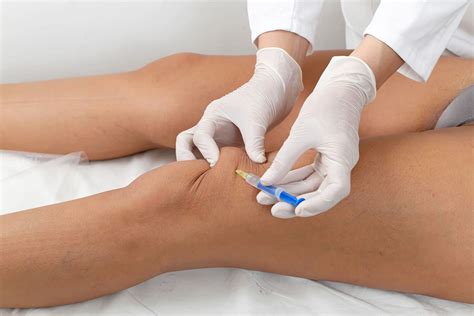 The Science of Knee Gel Injections: How They Work and Why They're Effective | Blog Post Archives ...