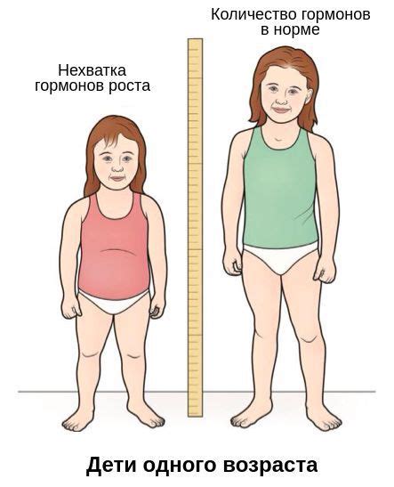 Гипофизарный нанизм (карликовость): причины, симптомы и лечение в ...