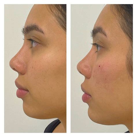 Eros Beauty and Wellness | #1 Medical Spa in San Diego