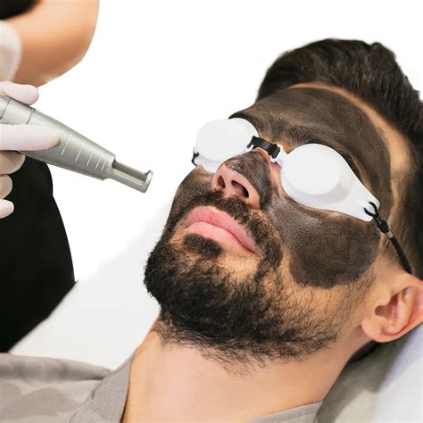 1 Carbon Facial Session – YaraOnline