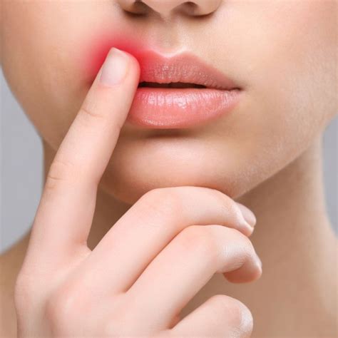 Lip Filler Swelling Stages: Navigate the Healing Journey for Perfect Lips!