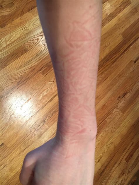 These wrinkles I found on my arm after a late sleep : r/mildlyinteresting