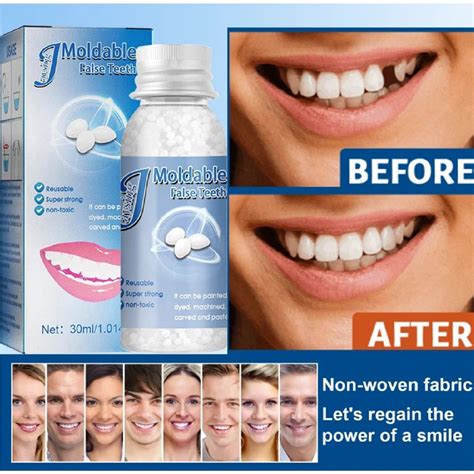 Tooth Filling Solid Denture Material Temporary Tooth DIY False Teeth ...