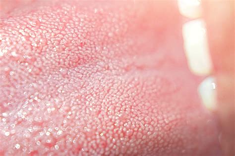 8 Causes of Bumps on the Back of the Tongue