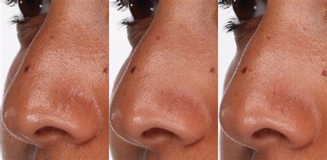 Makeup For Large Pores Nose - Makeup Vidalondon