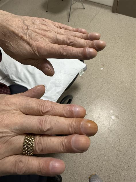 MRCP PACES Exam Dates and Preparation Time 2025: Everything You Need To Know