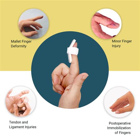 Finger Splint Cvs