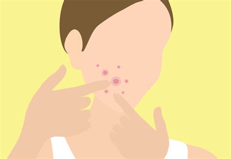 Download Popping Pimples Outline [wallpaper] Wallpaper | Wallpapers.com