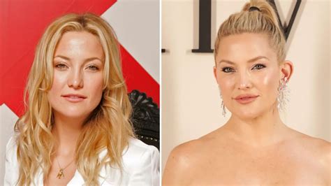 Kate Hudson Plastic Surgery - Surgerytr