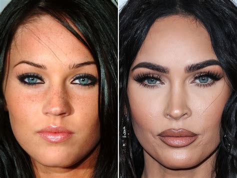 Megan Fox Before And After Face Surgery