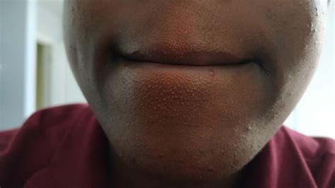 Part 1: Ideas for how to get rid/minimize these tiny bumps under my ...