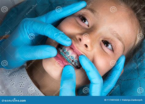 Zahnarzt, Orthodontist Untersuchungsein Kleines Mädchen Geduldige ` S Zähne Stockbild - Bild von ...