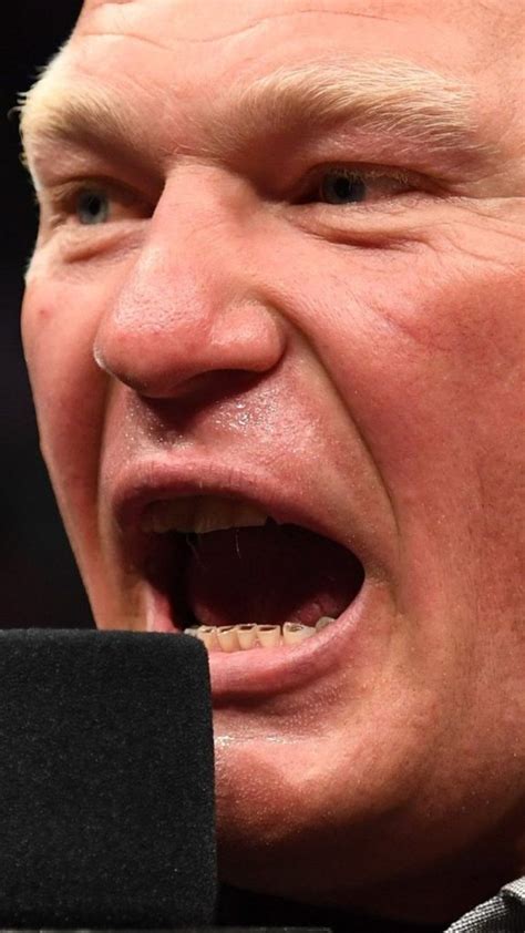 Report: What the hell is going on with Brock Lesnar's teeth?
