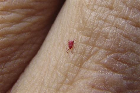 Deadly typhus spread by mite bites now found in US