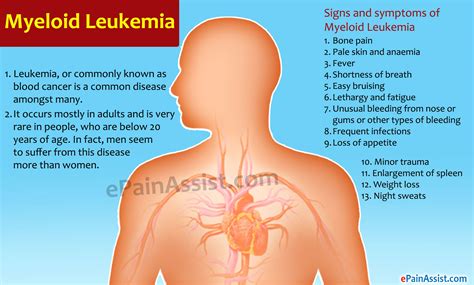 Myeloid Leukemia|Causes|Symptoms|Treatment|Survival Rate|Life Expectancy