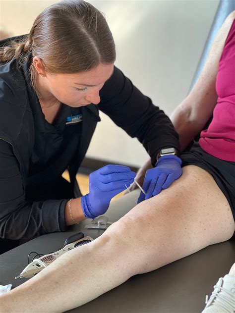Does Dry Needling Hurt? What to Expect During Your First Session