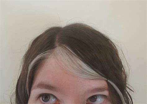 White Hair, Don't Care: What It's Like Living With An Unusual Birthmark ...