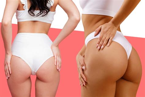 BBL Meaning: Slang, Surgery & The Hype Explained (2025) 👩‍⚕️👨‍⚕️