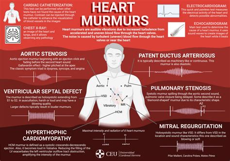 Heart murmurs