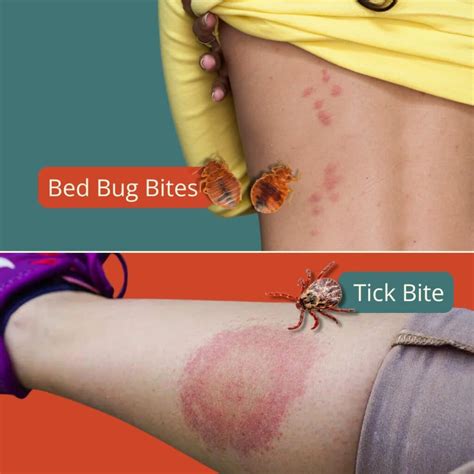 Tick Vs Bed Bug & Why It Matters | Inside & Out Pest Services