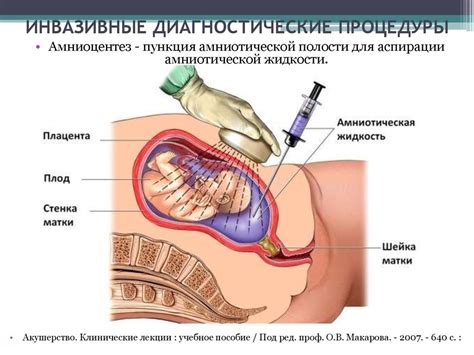Методы пренатальной дианостики - презентация онлайн