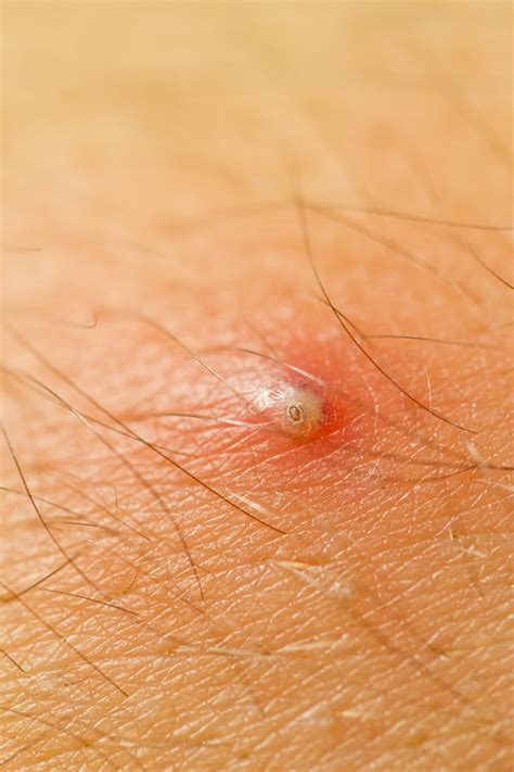 8 Common Causes of Itchy Bumps and Lumps Around Your Vagina