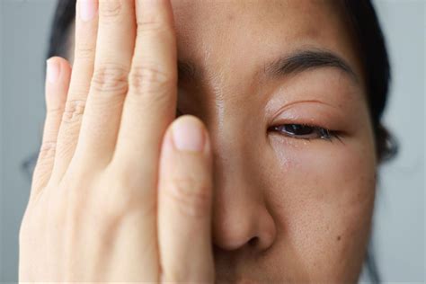 Open Globe Injury: Urgent Care to Protect Vision
