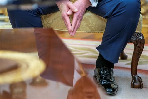 President Trump's Diagnosis: Chronic Venous Insufficiency (CVI)