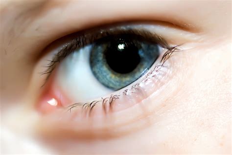 Eyelid Twitch Causes Treatments And Prevention Why Is Your Eye