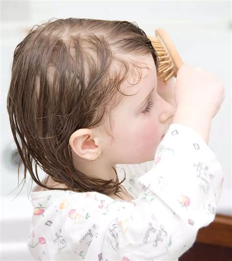 Baby Dry Scalp: Causes, Home Remedies And Treatment