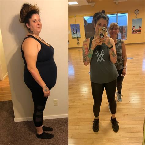 Okotoks woman's skin removal surgery not covered after 200-pound weight ...