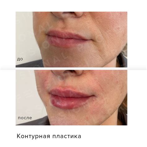 В данном случае мы добавили чувственности и выразительности губам. А ...
