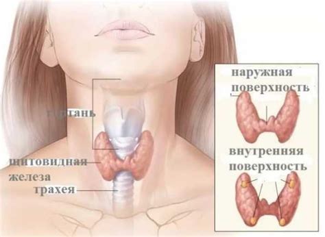 Понос желтый почему – Понос желтого цвета у взрослых: причины и лечение