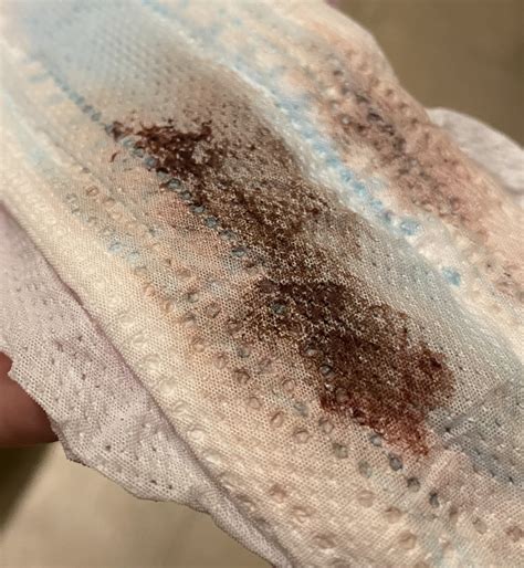 Is Implantation Bleeding Brown