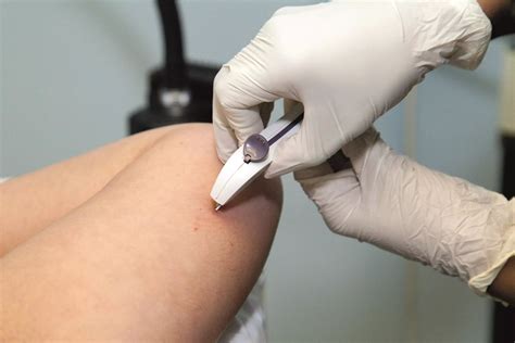 Contraceptive implant linked to repeat abortion - The Pharmaceutical Journal