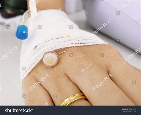 Close Iv Plug Patients Hand Heparin Stock Photo 702420697 | Shutterstock
