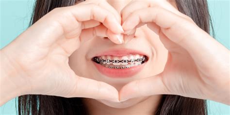 Does Braces Hurt? Tips for Easing the Pain and Discomfort