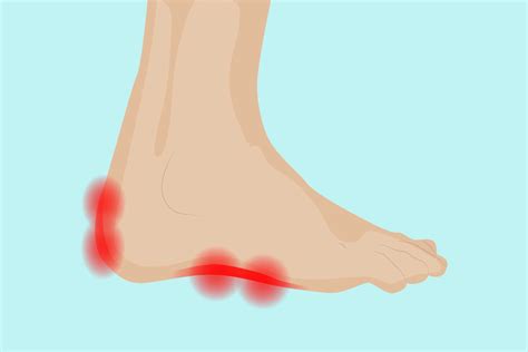 Burning Pain Bottom Of Foot Pain At The Back Of The Heel? How To