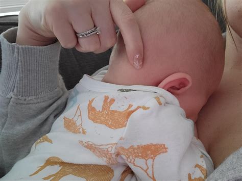 Bumps on babys head behind ears : r/newborns