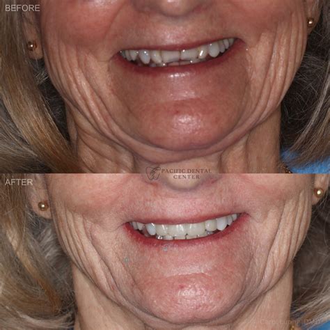 Smile Gallery - Pacific Dental Center
