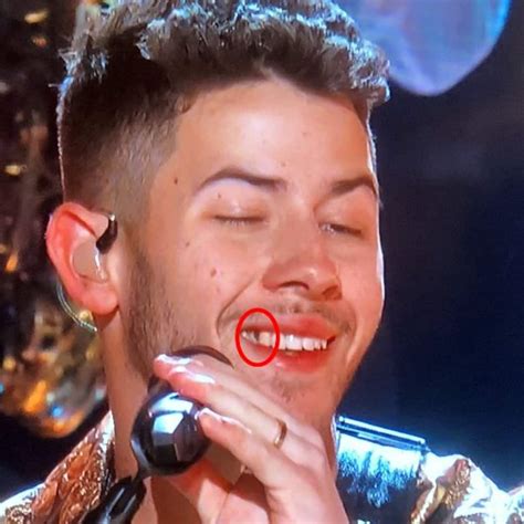 Grammys 2020: Nick Jonas having food stuck in his teeth while ...