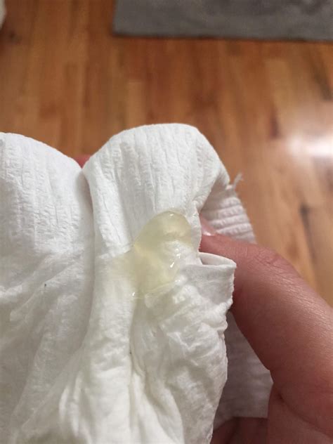 What Does a Mucus Plug Look Like? (With 11 Mucus Plug Photos)