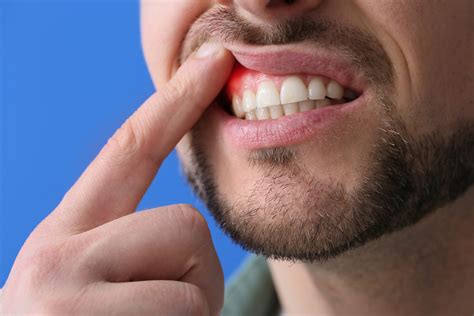 Why Do My Gums Hurt in the Back: Find the Real Reason Behind It! - The ...