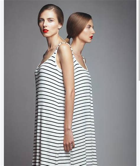 Conjoined twins who share a vagina but have different sexual ...