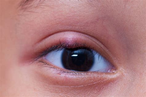 Herbs That Cure Eye Problems at Santiago Vanmatre blog