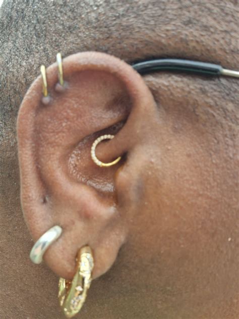 tiny bumps on cartilage : r/piercing