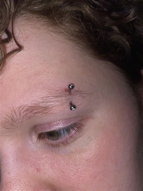 Eyebrow piercing keloid? : r/Legitpiercing