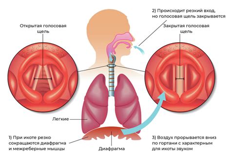 Как избавиться от икоты. Причины у взрослых, как быстро перестать икать ...
