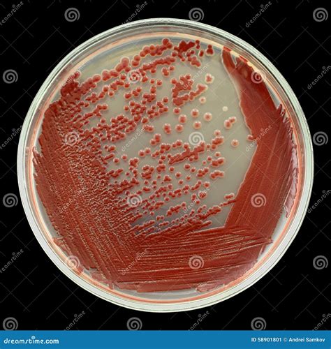 Petri Dish With Red Agar